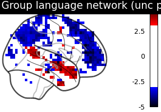 ../../_images/sphx_glr_plot_bids_analysis_002.png