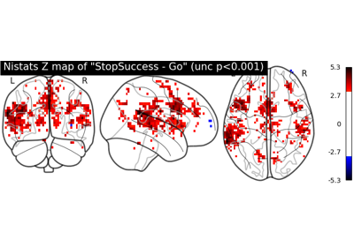 ../../_images/sphx_glr_plot_bids_features_thumb.png