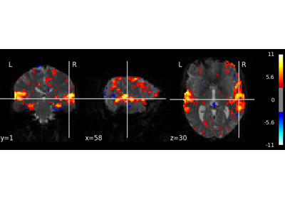 ../_images/sphx_glr_plot_predictions_residuals_thumb.png