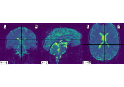 ../../_images/sphx_glr_plot_single_subject_single_run_thumb.png